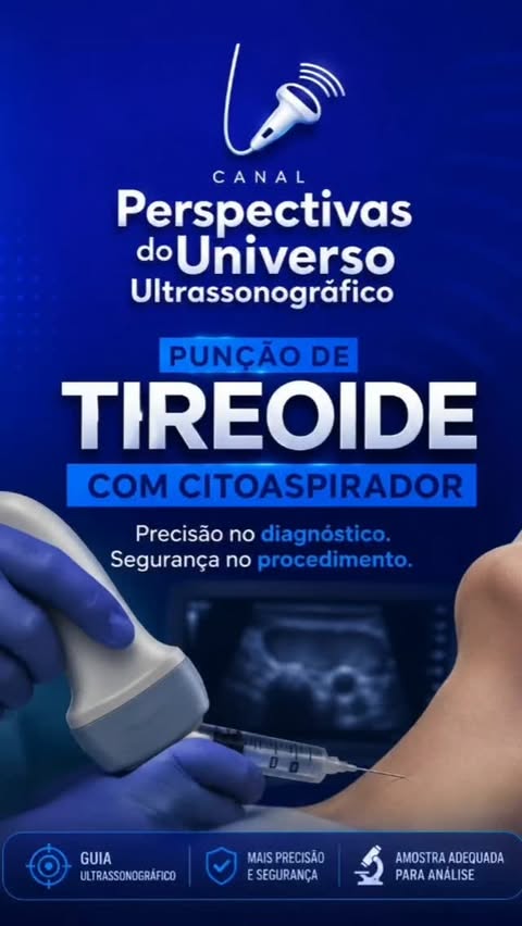Post sobre punção de tireoide guiada por ultrassom com citoaspirador